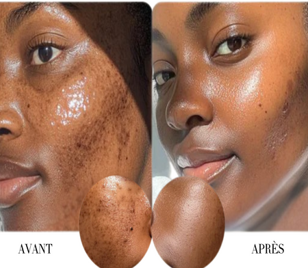 Masque purifiant à l’argile, curcuma et vitamine C