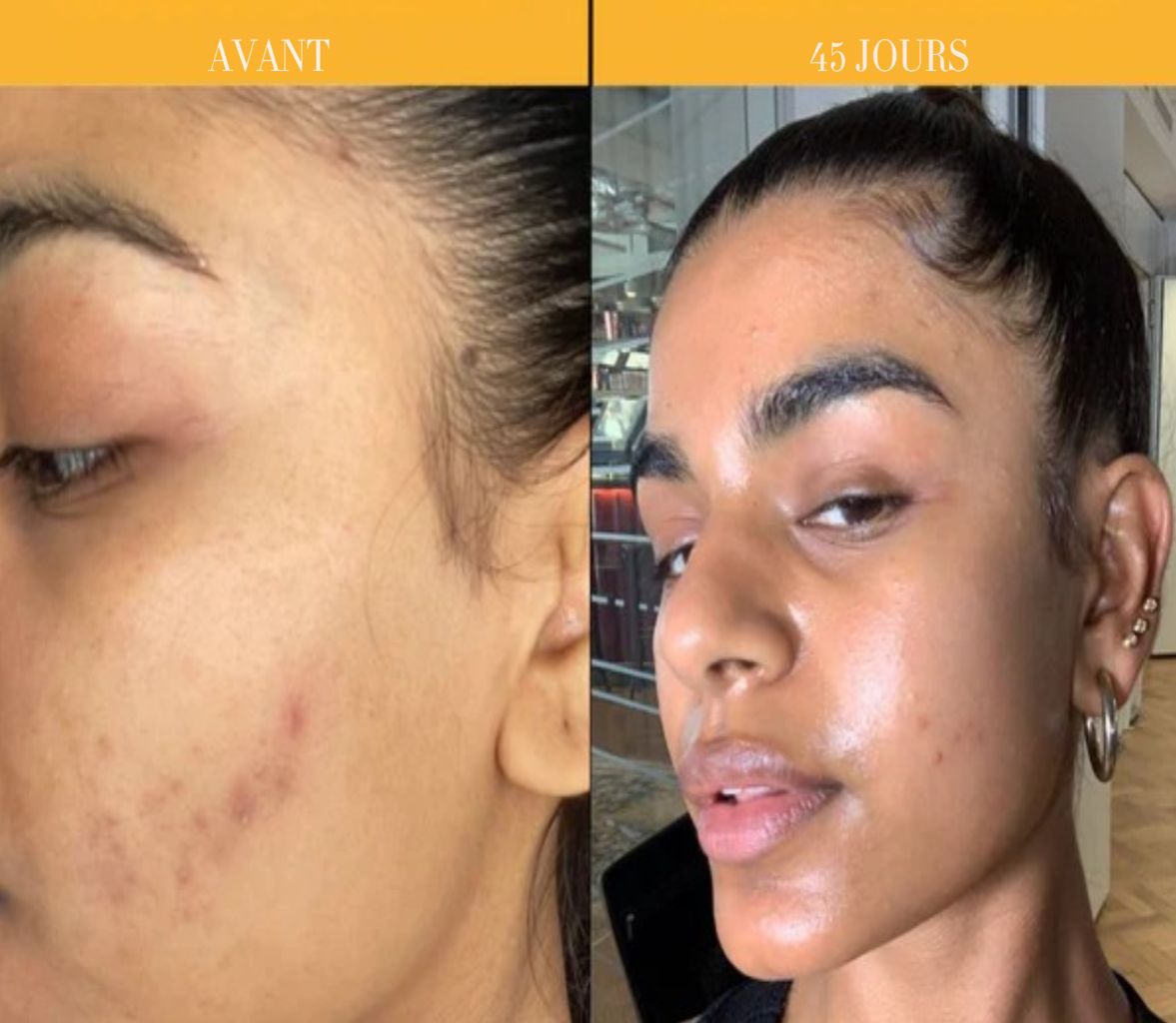 Créme Hydratante au Curcuma et la Vitamine C "Anti-Hyperpigmentation"